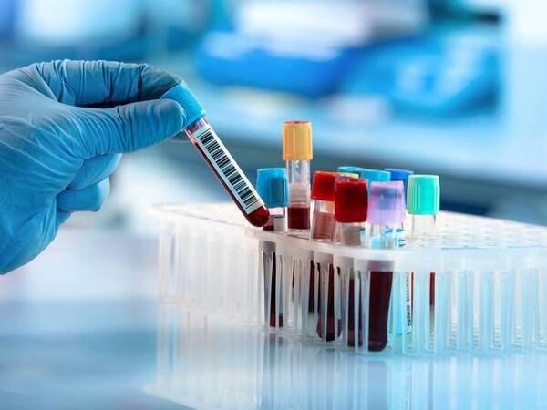 Lab Tests