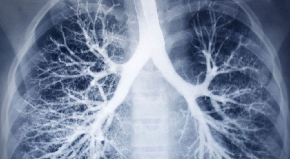 X-Ray – The Most Common and Essential Diagnostic Tool