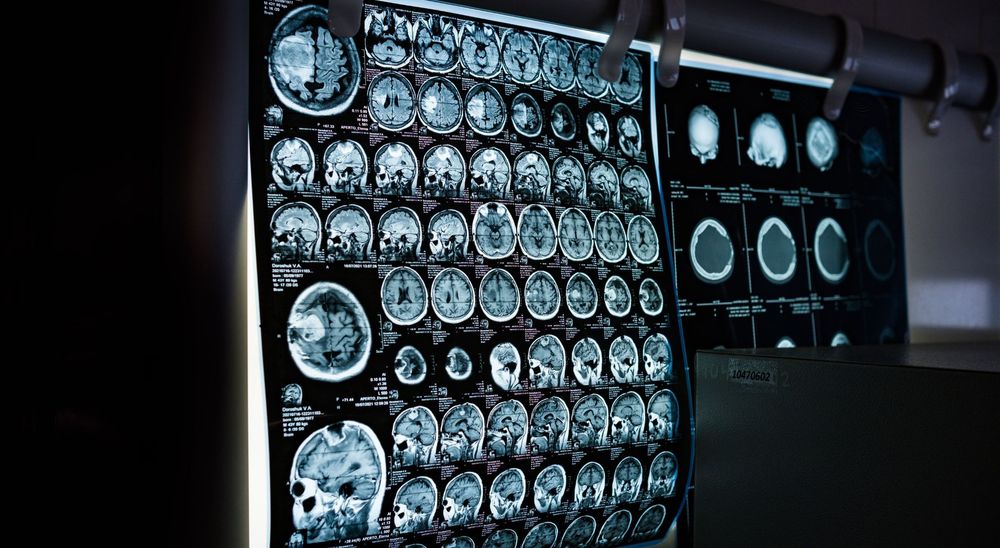 MRI – Imaging with Clarity and Comfort