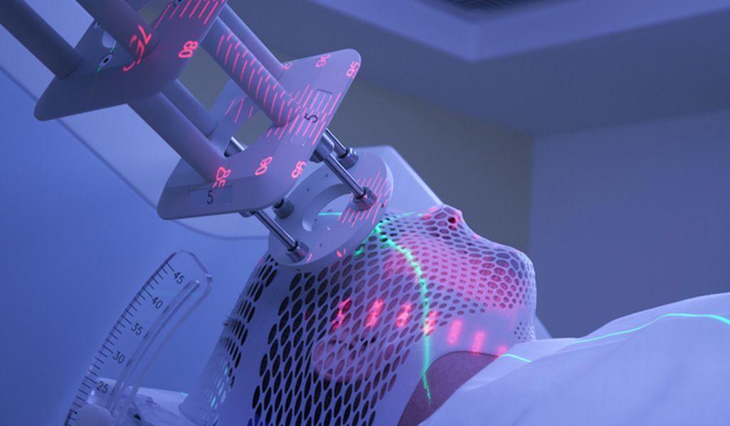 Radiotherapy